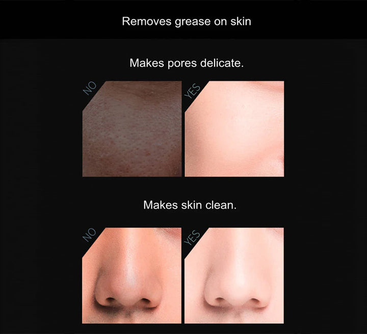 Volcanic Stone Oil-Absorbing Face Roller - Exquisite Beauty